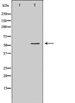 HCK Antibody in Western Blot (WB)