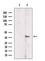 SCCPDH Antibody in Western Blot (WB)