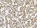 MDA5 Antibody in Immunohistochemistry (Paraffin) (IHC (P))