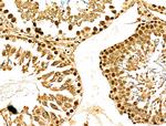 MDA5 Antibody in Immunohistochemistry (Paraffin) (IHC (P))