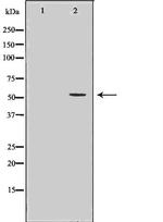 IMPDH2 Antibody in Western Blot (WB)