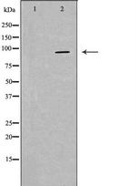 PKP2 Antibody in Western Blot (WB)