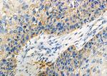 CRYBB2 Antibody in Immunohistochemistry (Paraffin) (IHC (P))