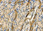 WNK3 Antibody in Immunohistochemistry (Paraffin) (IHC (P))