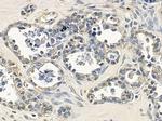 Importin 9 Antibody in Immunohistochemistry (Paraffin) (IHC (P))