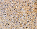 MYL12A Antibody in Immunohistochemistry (Paraffin) (IHC (P))