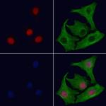 PABPN1 Antibody in Immunocytochemistry (ICC/IF)