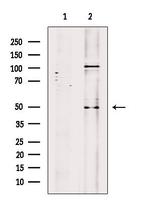 PABPN1 Antibody in Western Blot (WB)