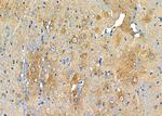 MT-CO2 Antibody in Immunohistochemistry (Paraffin) (IHC (P))