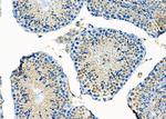 MT-CO2 Antibody in Immunohistochemistry (Paraffin) (IHC (P))