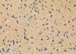 NDUFAF1 Antibody in Immunohistochemistry (Paraffin) (IHC (P))