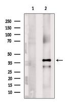 NDUFAF1 Antibody in Western Blot (WB)