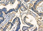 hCG beta-2 Antibody in Immunohistochemistry (Paraffin) (IHC (P))