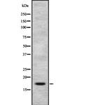 PIP Antibody in Western Blot (WB)