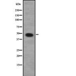 Calsequestrin 2 Antibody in Western Blot (WB)