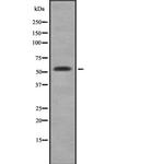 CYP3A5 Antibody in Western Blot (WB)