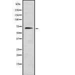 PKMYT1 Antibody in Western Blot (WB)