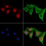 FUS Antibody in Immunocytochemistry (ICC/IF)