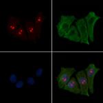 FUS Antibody in Immunocytochemistry (ICC/IF)