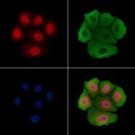 THOC5 Antibody in Immunocytochemistry (ICC/IF)