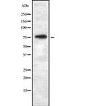 THOC5 Antibody in Western Blot (WB)