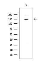 BRCAA1 Antibody in Western Blot (WB)