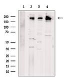 SCN2A Antibody in Western Blot (WB)