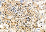 UCP2 Antibody in Immunohistochemistry (Paraffin) (IHC (P))