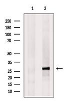 eIF4E3 Antibody in Western Blot (WB)