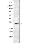 OR10K1/OR10K2 Antibody in Western Blot (WB)