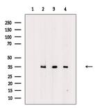 OR2A5/OR2A14 Antibody in Western Blot (WB)