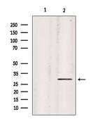 COL9A2 Antibody in Western Blot (WB)