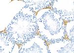 COL16A1 Antibody in Immunohistochemistry (Paraffin) (IHC (P))