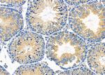 COX7C Antibody in Immunohistochemistry (Paraffin) (IHC (P))