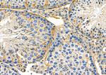 CRLF3 Antibody in Immunohistochemistry (Paraffin) (IHC (P))