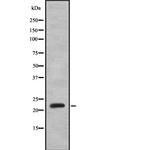 Interferon alpha-8 Antibody in Western Blot (WB)