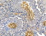 AGPAT1 Antibody in Immunohistochemistry (Paraffin) (IHC (P))