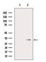 AGPAT1 Antibody in Western Blot (WB)