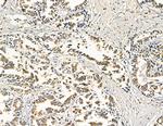 ABHD10 Antibody in Immunohistochemistry (Paraffin) (IHC (P))