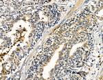 ABHD10 Antibody in Immunohistochemistry (Paraffin) (IHC (P))