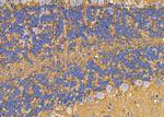 ABHD10 Antibody in Immunohistochemistry (Paraffin) (IHC (P))