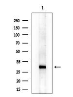 ABHD10 Antibody in Western Blot (WB)