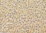 CHRNG Antibody in Immunohistochemistry (Paraffin) (IHC (P))