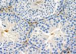 CHRNG Antibody in Immunohistochemistry (Paraffin) (IHC (P))