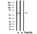 CHRNG Antibody in Western Blot (WB)