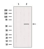 CHRNG Antibody in Western Blot (WB)