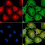 LPGAT1 Antibody in Immunocytochemistry (ICC/IF)