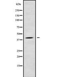 LPGAT1 Antibody in Western Blot (WB)