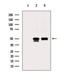 ACOT9 Antibody in Western Blot (WB)