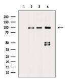 ADAM30 Antibody in Western Blot (WB)